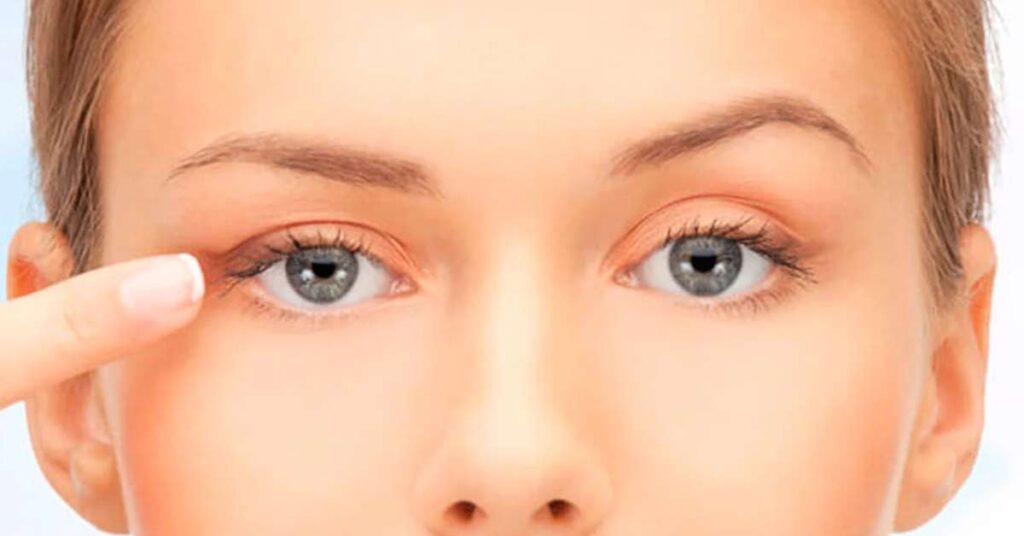 Guia completo sobre blefaroplastia - o que você precisa saber antes de decidir